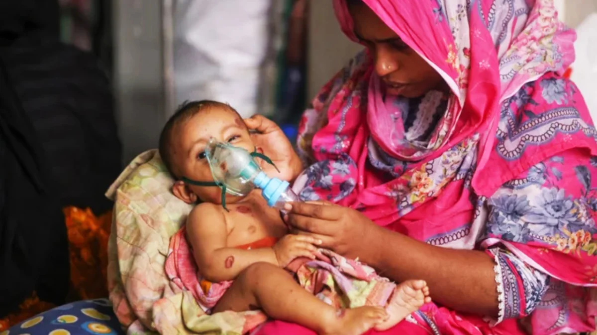সারাদেশে হাম উপসর্গে আরও ৯ শিশুর মৃত্যু